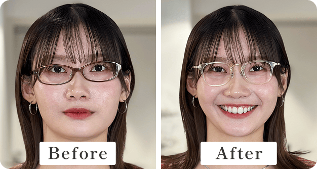 メガネをかけた女性Before After